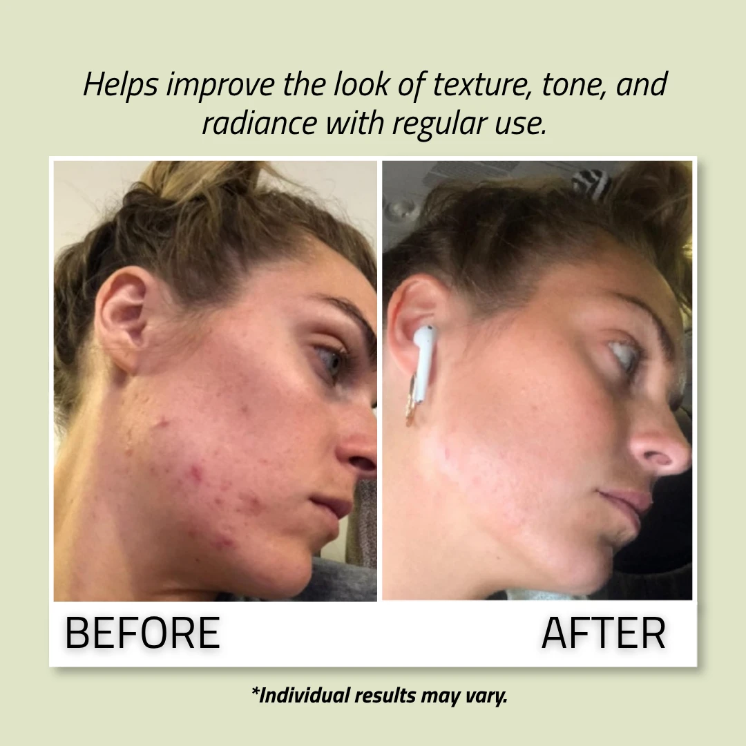 Glycolic Acid Pads — packaging and product detail